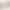 حذف به قرینهٔ لفظی و معنایی: حذف بخشی از جمله که صورت یا نشانهٔ آن در بخش دیگری از سخن آمده باشد یا بتوان آن را از معنای سخن دریافت