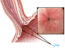 بندارۀ انتهای مری