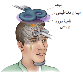 معاینۀ مغز با نیروهای محرکۀ القایی