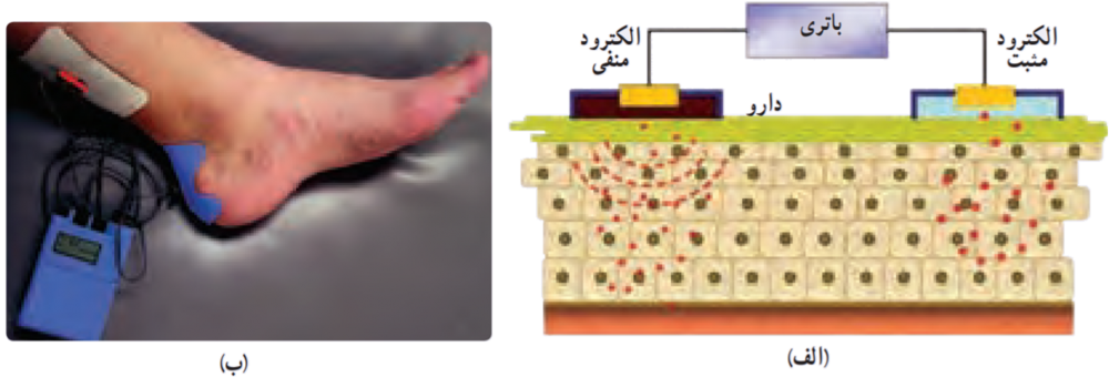  یون رانی
