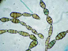 اسپورهای آلترناریا در زیر میکروسکوپ (Alternaria alternata)