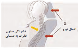   طرح صندلی و پشت سری ایمن در برخورد از عقب