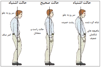   مقایسه وضعیت ایستادن درست و نادرست